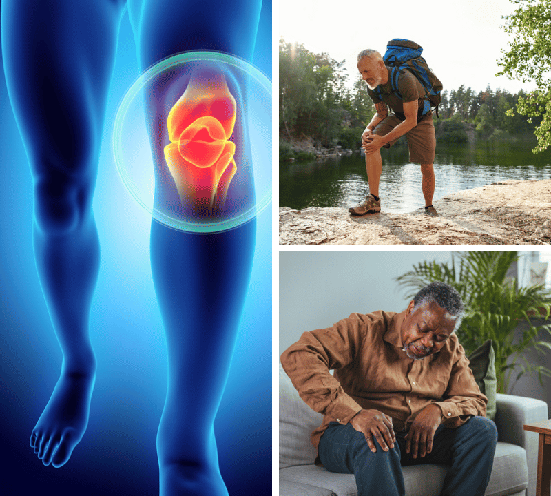 The Ultimate Guide to the Best Joint Supplement for Knees: Say Goodbye to Pain